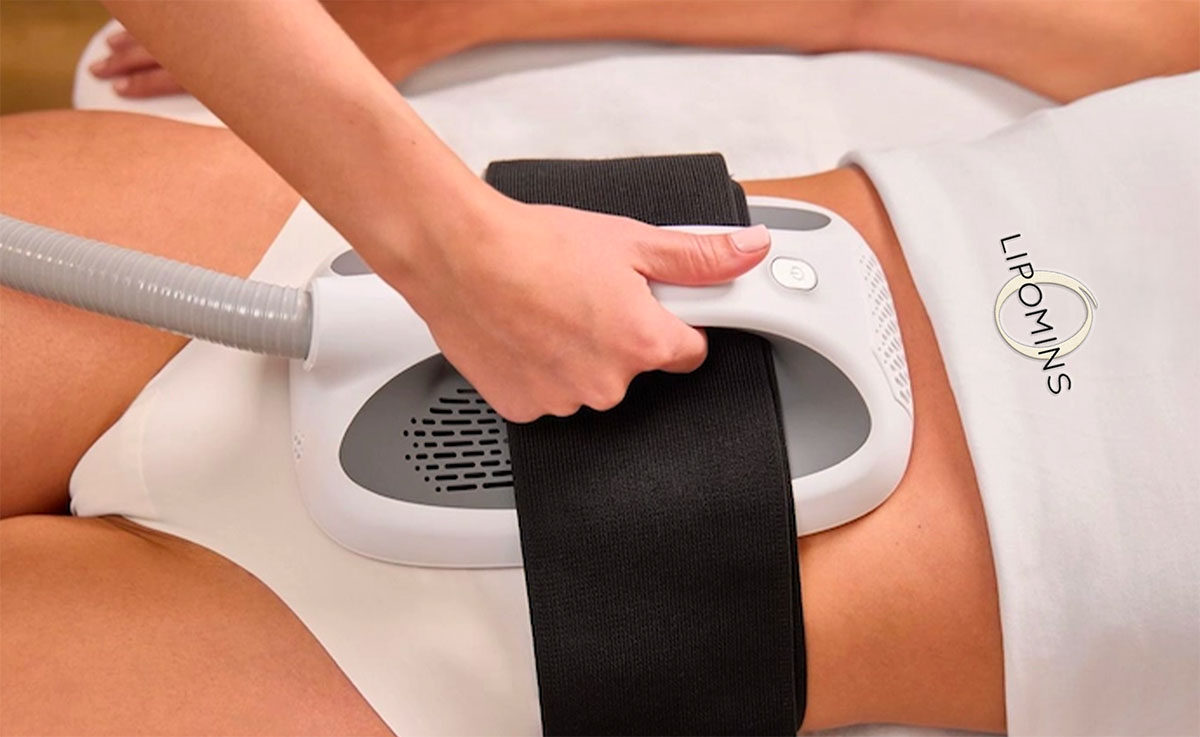 soins minceur à Cannes LIPOMINS